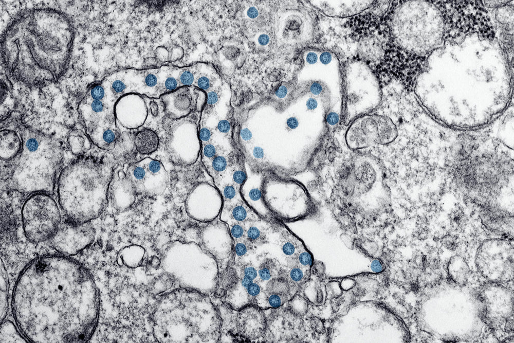 The Fibre Your Brain Has Been Waiting For