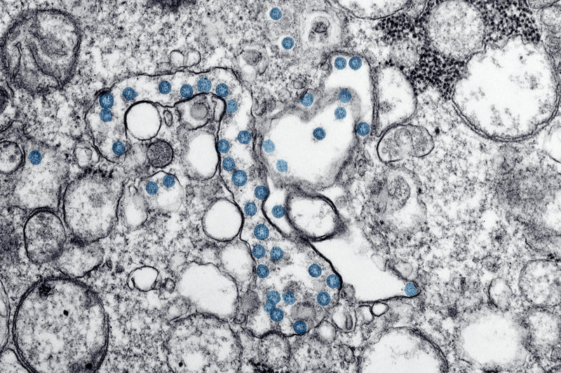 The Fibre Your Brain Has Been Waiting For